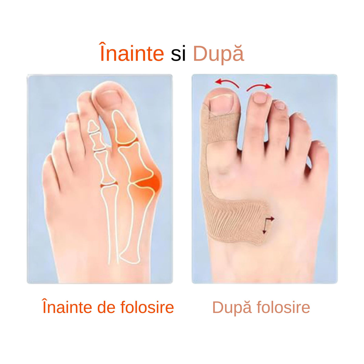 45% REDUCERE - EasyStep - Benzi Ortopedice Degetul Mare Deviat - (20 buc/set)