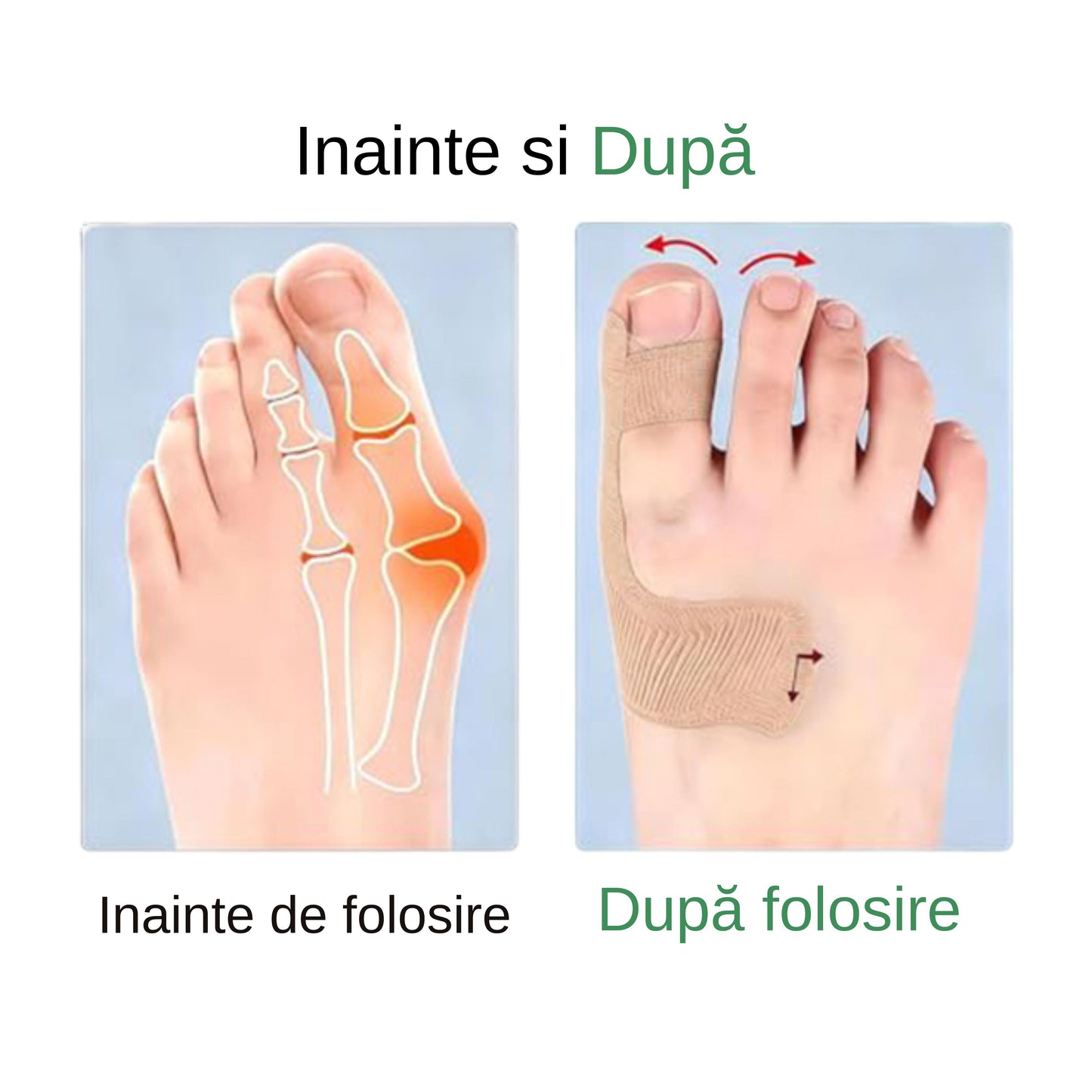 Kit 20 Benzi Corective Degetul Mare - Pre-tăiate (20 buc)